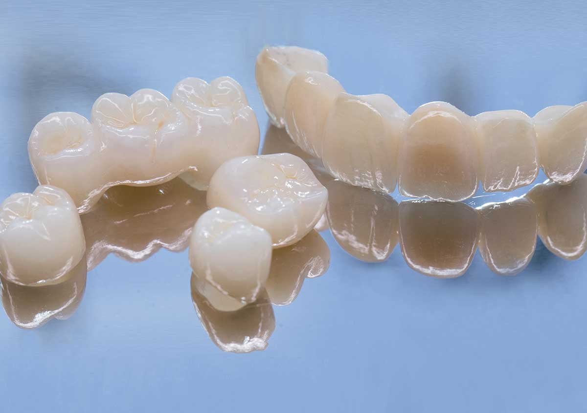 Dental Implants in Burbank